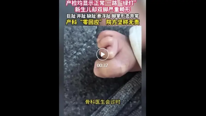 产检一路“绿灯”,宝宝出生后双脚却严重畸形,医院回应:按筛查标准不检查四肢,属于医学盲区,主张无责任