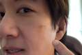 王力宏伤口即将拆线，宣布下一站开始取消威亚装置